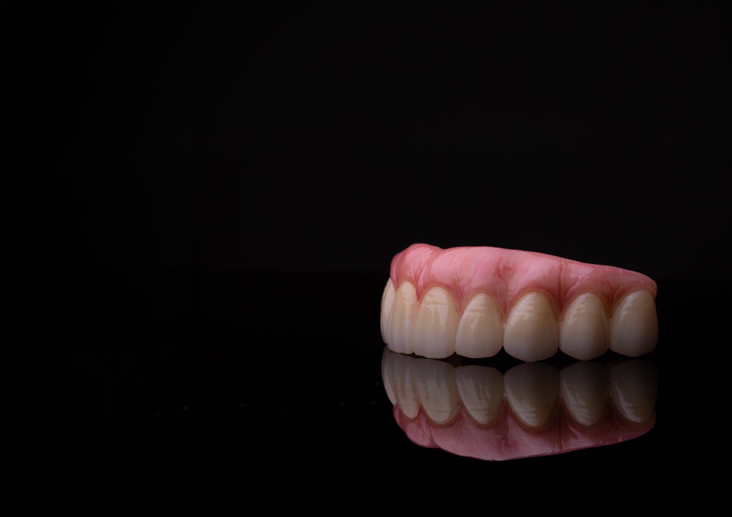 All-on-X full-arch dental prosthesis, crafted by Tan Khuu, DDS